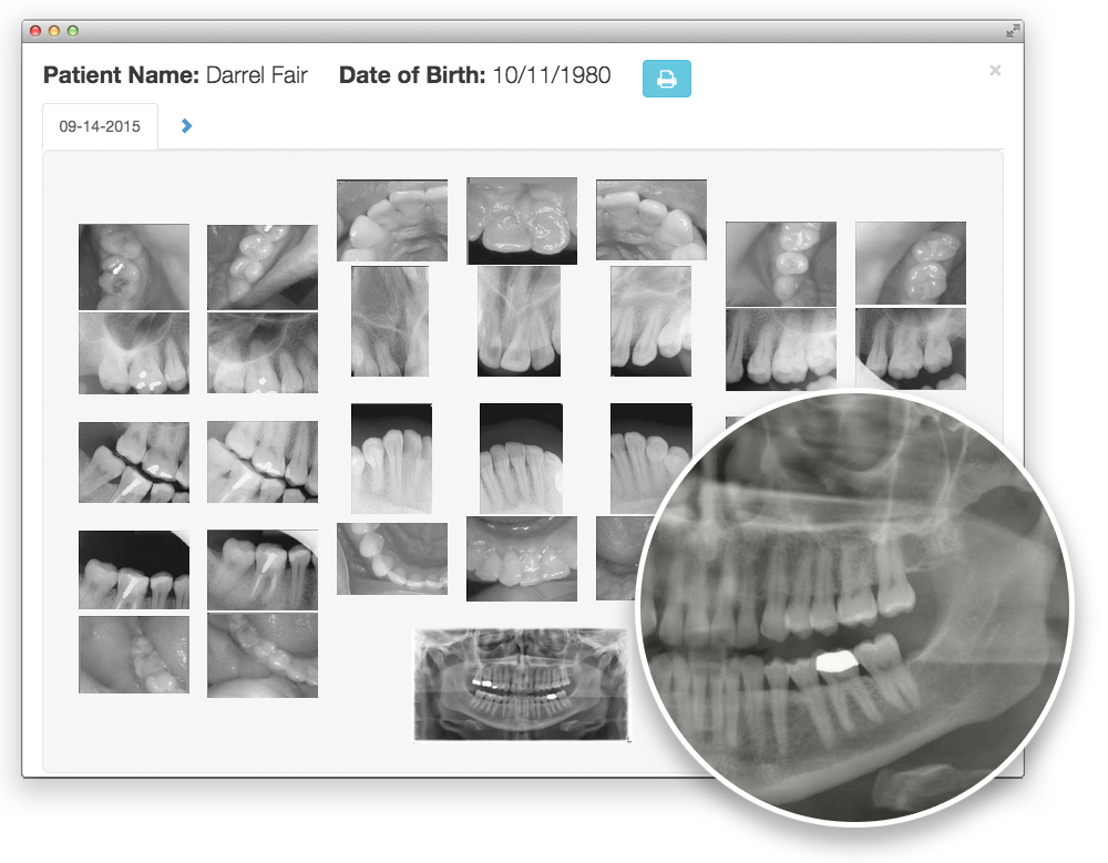 Dental XRay Images On Cloud