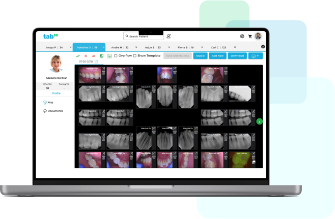 tab32 Launches Plug-and-Play Cloud Imaging for Dentists and Dental Practices